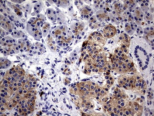 CD63 Antibody in Immunohistochemistry (Paraffin) (IHC (P))