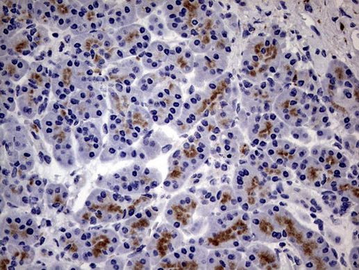 CD63 Antibody in Immunohistochemistry (Paraffin) (IHC (P))