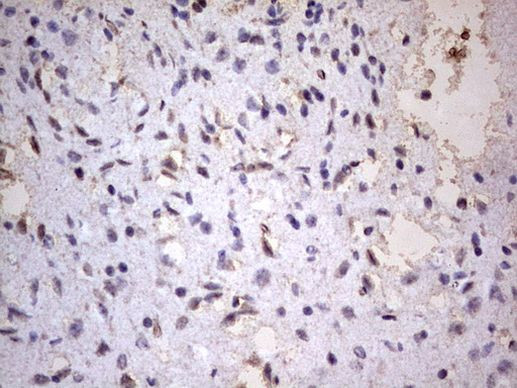 CD63 Antibody in Immunohistochemistry (Paraffin) (IHC (P))