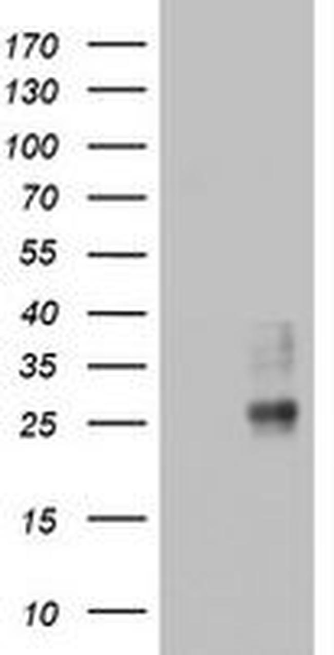 CD63 Antibody in Western Blot (WB)