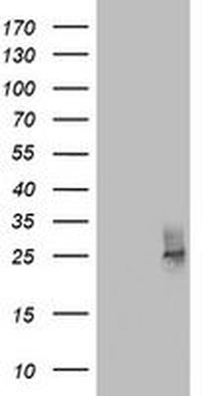 CD63 Antibody in Western Blot (WB)