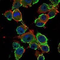 CEA Antibody in Immunocytochemistry (ICC/IF)
