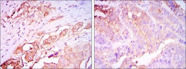 CEA Antibody in Immunohistochemistry (Paraffin) (IHC (P))