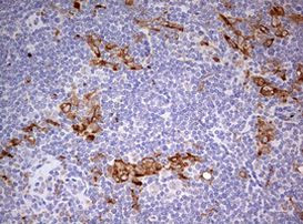 CD68 Antibody in Immunohistochemistry (Paraffin) (IHC (P))