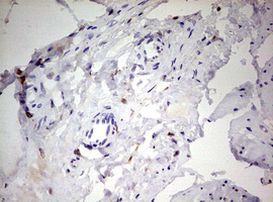CD68 Antibody in Immunohistochemistry (Paraffin) (IHC (P))