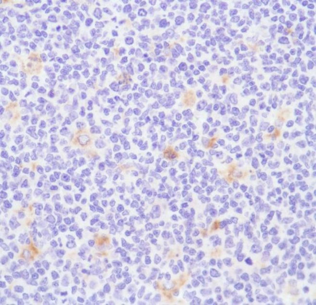 CD68 Antibody in Immunohistochemistry (Paraffin) (IHC (P))
