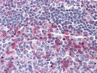 CD69 Antibody in Immunohistochemistry (Paraffin) (IHC (P))