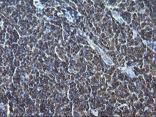 CD74 Antibody in Immunohistochemistry (Paraffin) (IHC (P))