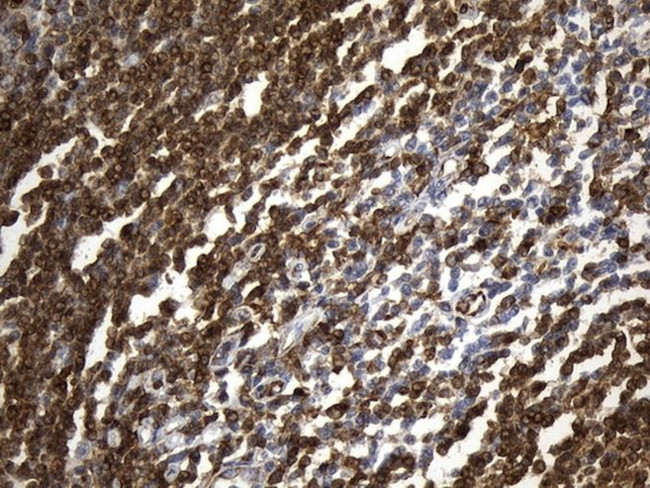 CD74 Antibody in Immunohistochemistry (Paraffin) (IHC (P))