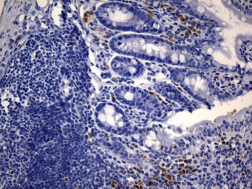 CD74 Antibody in Immunohistochemistry (Paraffin) (IHC (P))