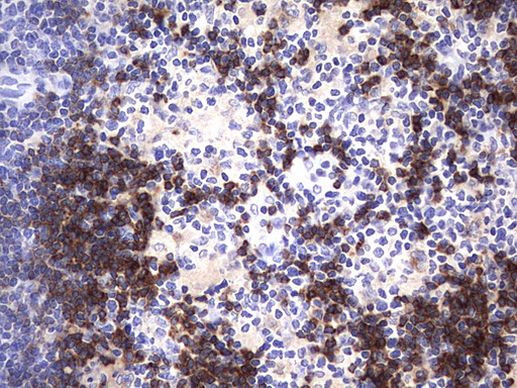 CD79A Antibody in Immunohistochemistry (Paraffin) (IHC (P))