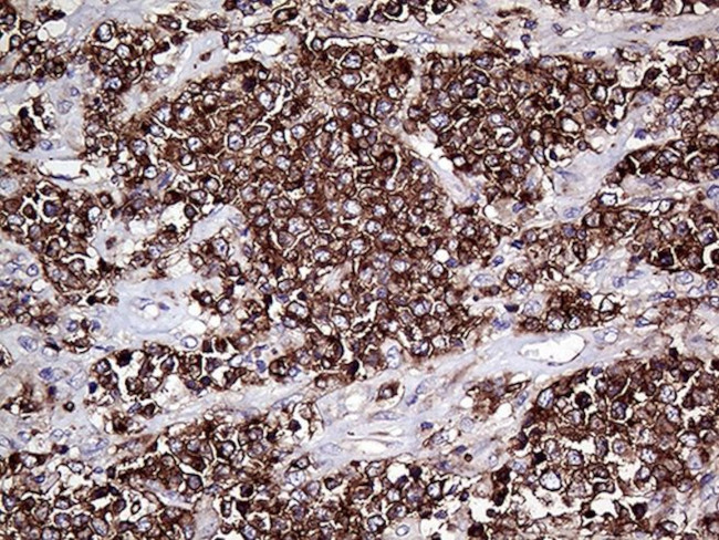 CD79B Antibody in Immunohistochemistry (Paraffin) (IHC (P))