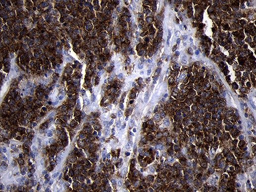 CD79B Antibody in Immunohistochemistry (Paraffin) (IHC (P))