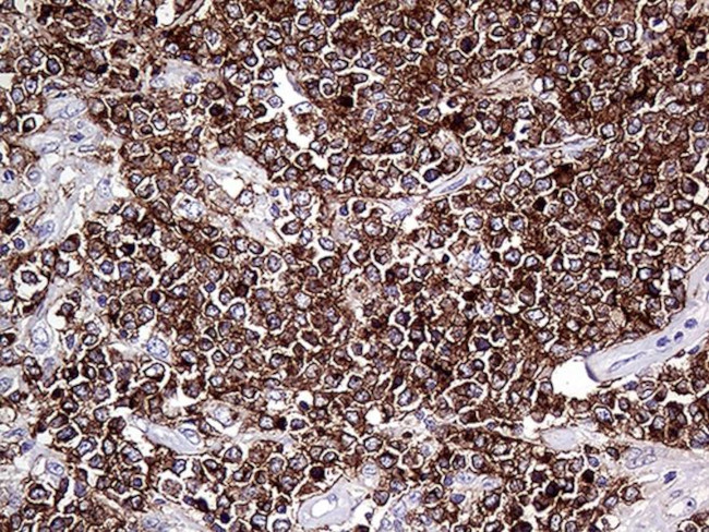CD79B Antibody in Immunohistochemistry (Paraffin) (IHC (P))