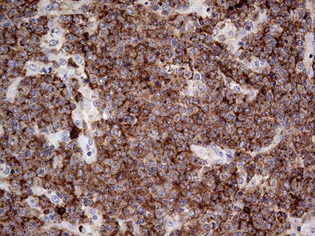 CD79B Antibody in Immunohistochemistry (Paraffin) (IHC (P))