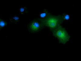 CD80 Antibody in Immunocytochemistry (ICC/IF)