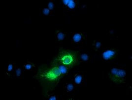 CD80 Antibody in Immunocytochemistry (ICC/IF)