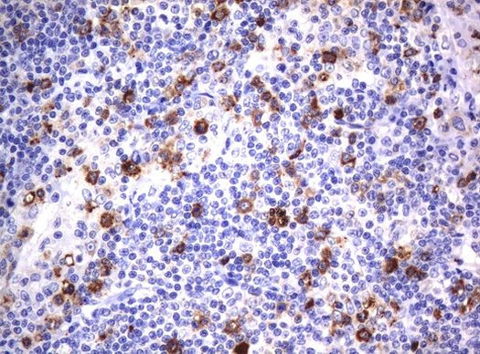 CD80 Antibody in Immunohistochemistry (Paraffin) (IHC (P))