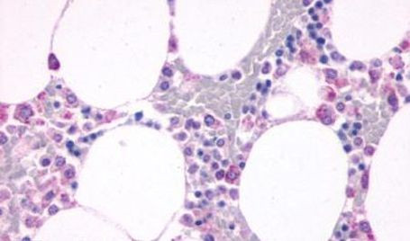 C5AR1 Antibody in Immunohistochemistry (Paraffin) (IHC (P))