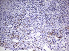 CD8A Antibody in Immunohistochemistry (Paraffin) (IHC (P))