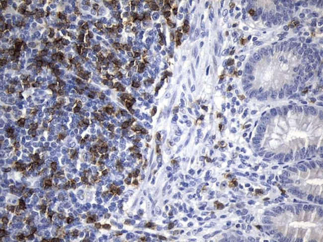 CD8A Antibody in Immunohistochemistry (Paraffin) (IHC (P))