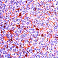 CD9 Antibody in Immunohistochemistry (IHC)