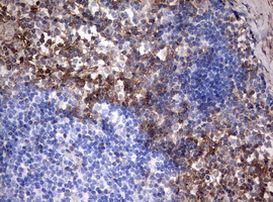 CD99 Antibody in Immunohistochemistry (Paraffin) (IHC (P))