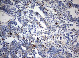 CD99 Antibody in Immunohistochemistry (Paraffin) (IHC (P))