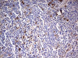 CD99 Antibody in Immunohistochemistry (Paraffin) (IHC (P))