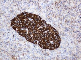 CD99 Antibody in Immunohistochemistry (Paraffin) (IHC (P))