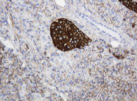CD99 Antibody in Immunohistochemistry (Paraffin) (IHC (P))