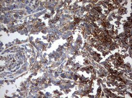 CD99 Antibody in Immunohistochemistry (Paraffin) (IHC (P))