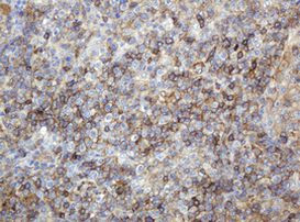 CD99 Antibody in Immunohistochemistry (Paraffin) (IHC (P))