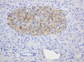 CD99 Antibody in Immunohistochemistry (Paraffin) (IHC (P))