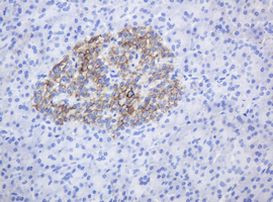 CD99 Antibody in Immunohistochemistry (Paraffin) (IHC (P))
