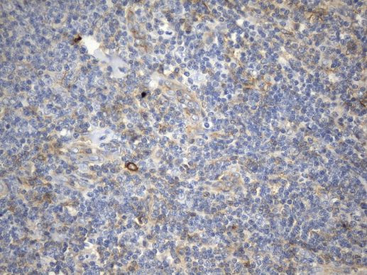 CD99 Antibody in Immunohistochemistry (Paraffin) (IHC (P))