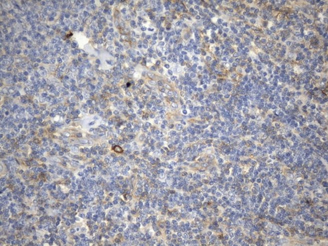 CD99 Antibody in Immunohistochemistry (Paraffin) (IHC (P))