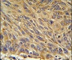 CD99L2 Antibody in Immunohistochemistry (IHC)