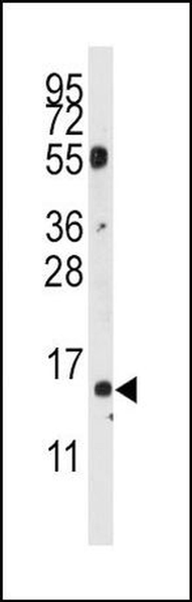 CDA Antibody in Western Blot (WB)
