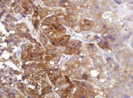CDC123 Antibody in Immunohistochemistry (Paraffin) (IHC (P))