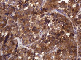 CDC123 Antibody in Immunohistochemistry (Paraffin) (IHC (P))