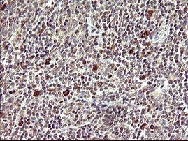 CDC123 Antibody in Immunohistochemistry (Paraffin) (IHC (P))