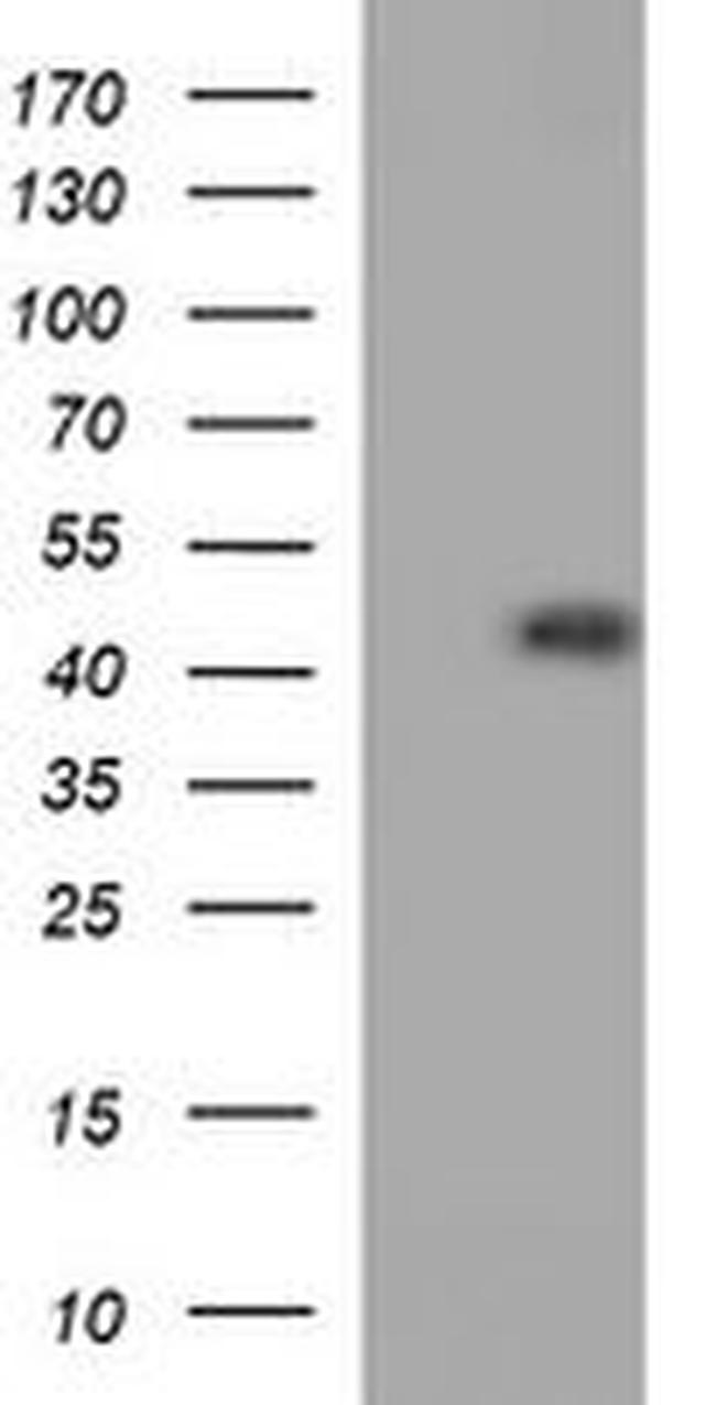 CDC123 Antibody in Western Blot (WB)