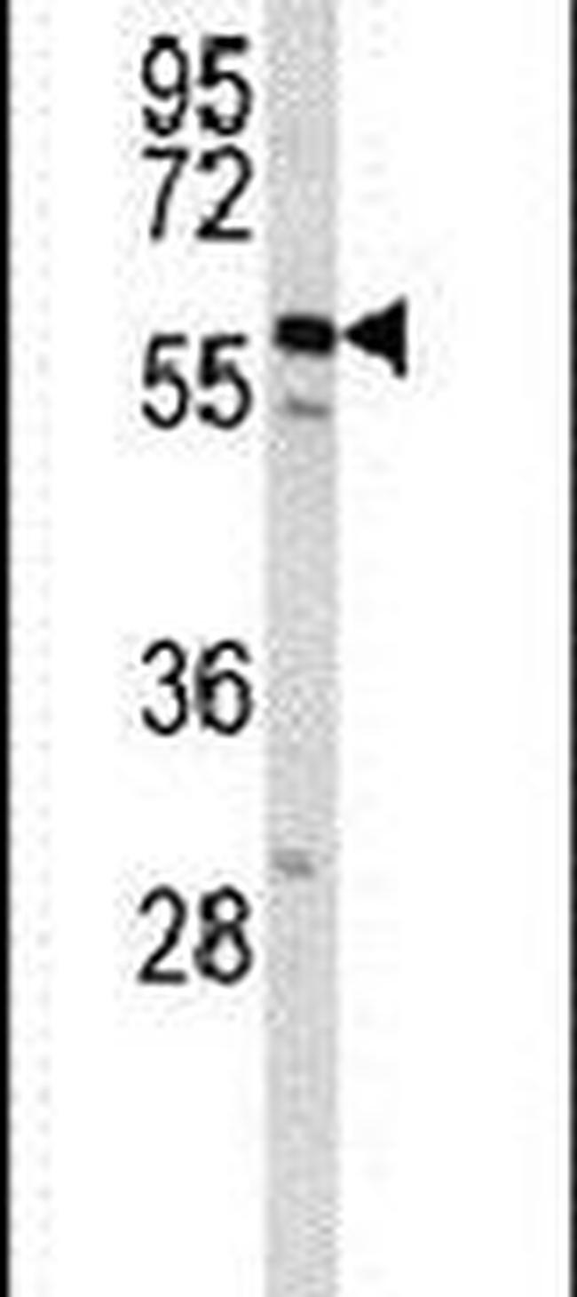Cdc14B Antibody in Western Blot (WB)