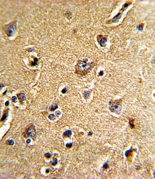 Cdc23 Antibody in Immunohistochemistry (IHC)