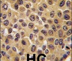 Cdc25B Antibody in Immunohistochemistry (IHC)