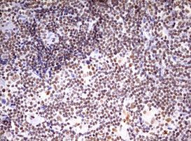 CDCA7L Antibody in Immunohistochemistry (Paraffin) (IHC (P))