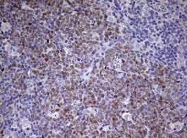 CDCA7L Antibody in Immunohistochemistry (Paraffin) (IHC (P))