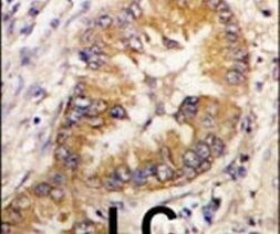 CDCA8 Antibody in Immunohistochemistry (IHC)