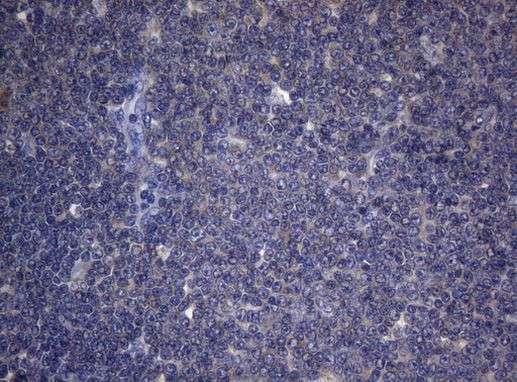 CDCA8 Antibody in Immunohistochemistry (Paraffin) (IHC (P))